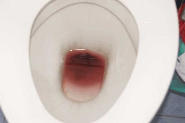 Mancha nos homes cando están excitados